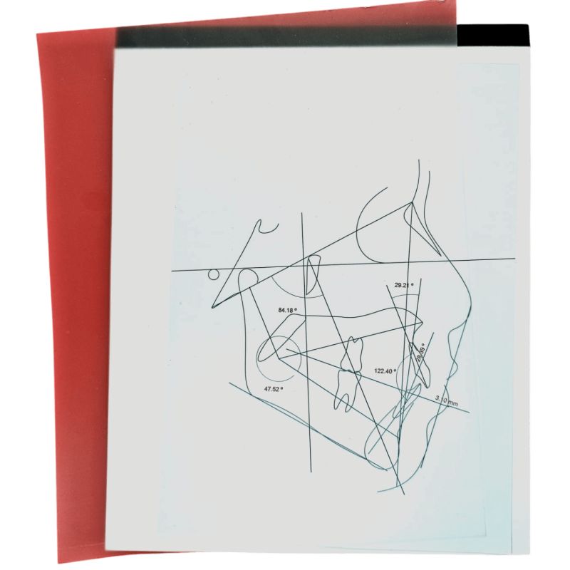 Acetato para cefalometría suelto