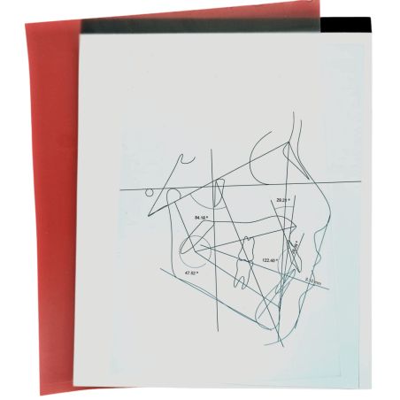 Block de acetatos para trazado cefalométrico (100)