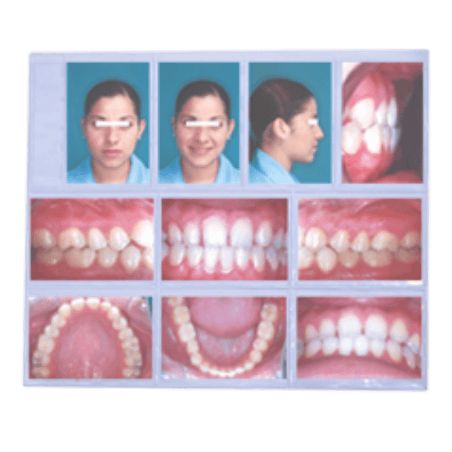 Mica para 10 fotografías