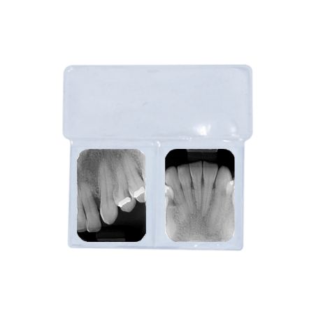 Mica para 2 periapicales