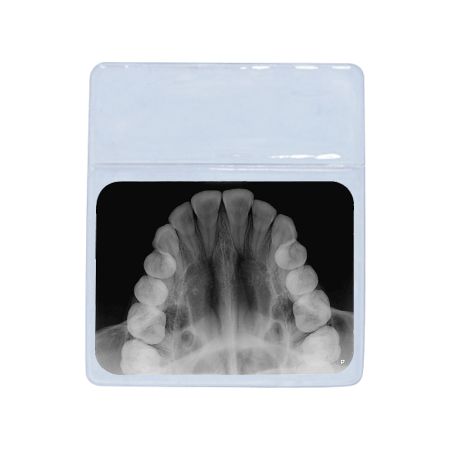 Mica para oclusal individual