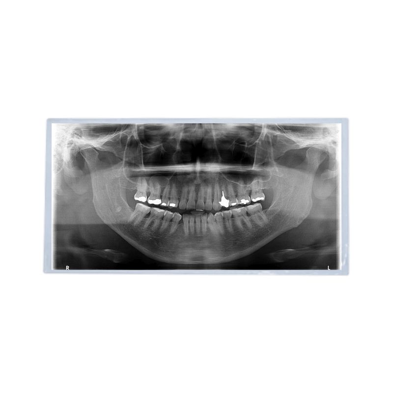 Mica para panorámica cal. 5.5