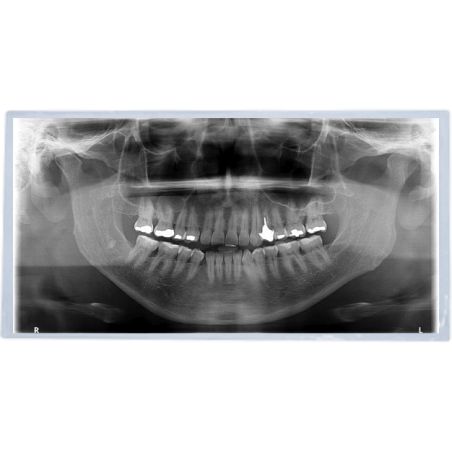 Mica para panorámica cal. 5.5