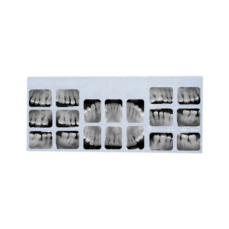 Mica para periapical