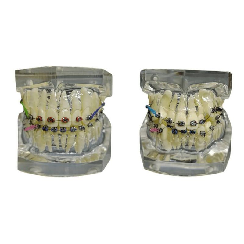 Tipodonto con brackets
