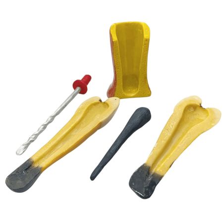 Tratamiento de endodoncia