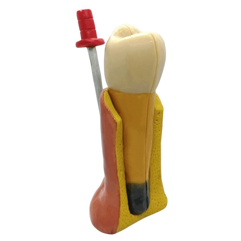 Tratamiento de endodoncia